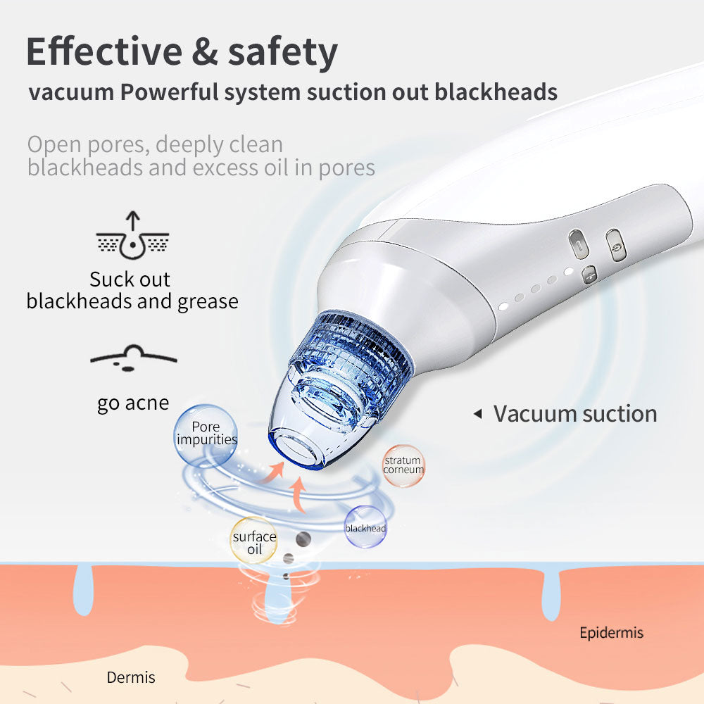 Electric Blackhead Suction Instrument | Home Blackhead Removal Beauty Tool