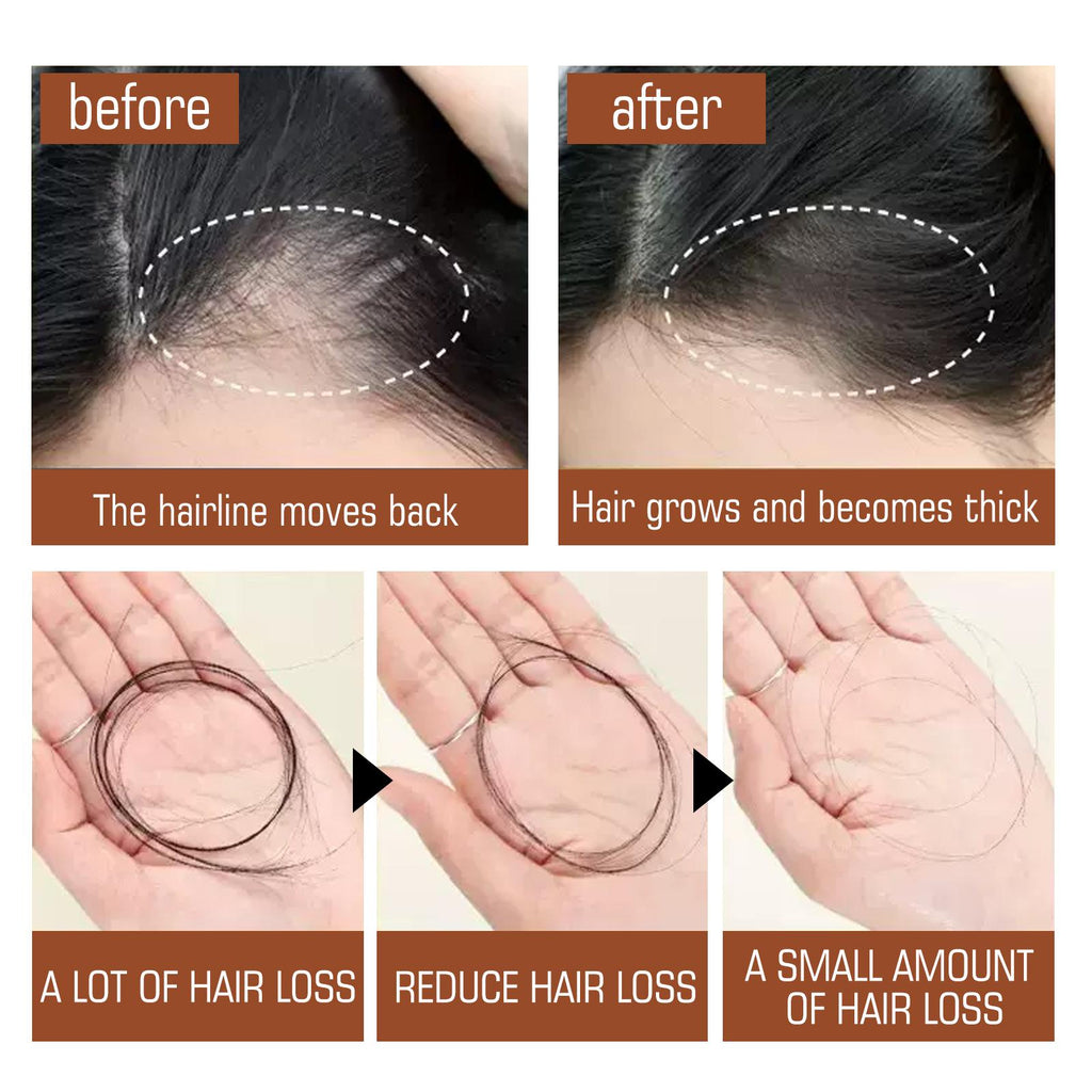 Batana Oil from Honduras | Fuller, Thicker & Healthier Hair Conditioner for Women & Men