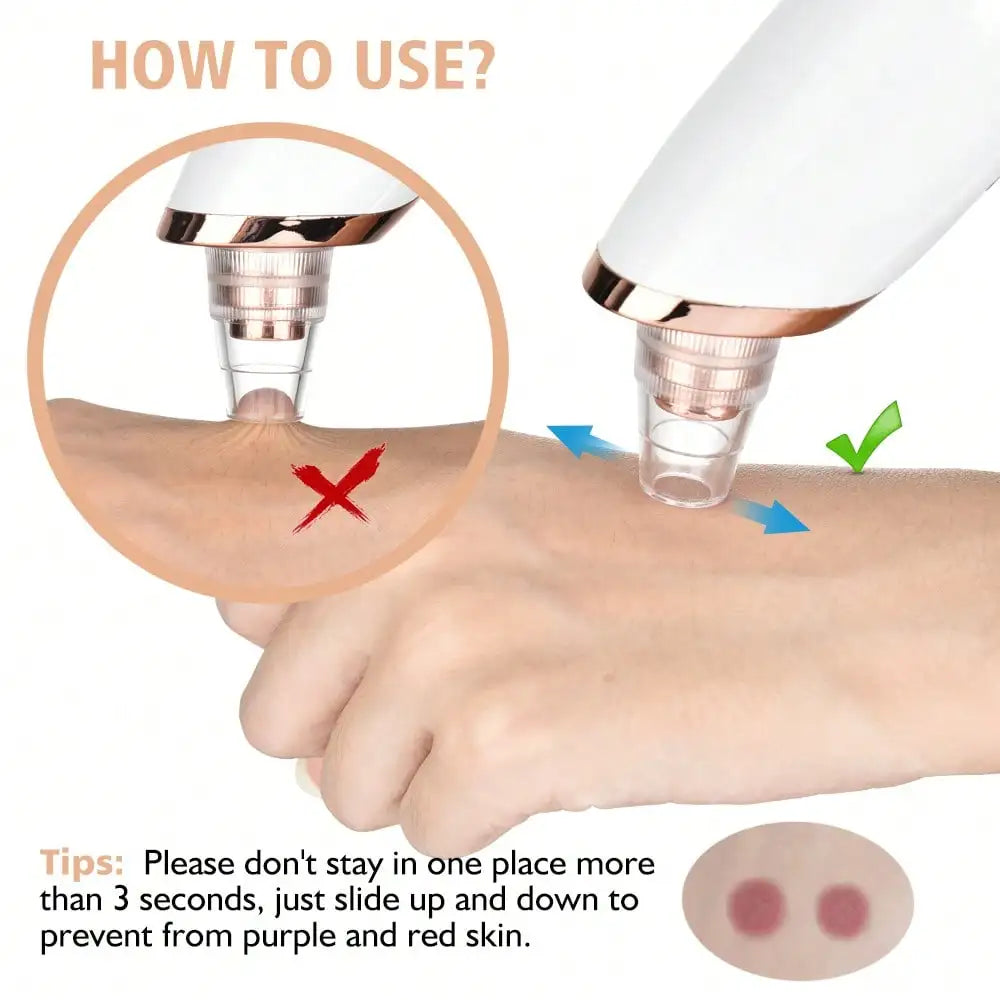 Electric Vacuum Suction Blackhead Remover USB Rechargeable Facial Pore Cleaner Comedone Spot Acne Pimple Black Head Extractor Face Skin Care Tools