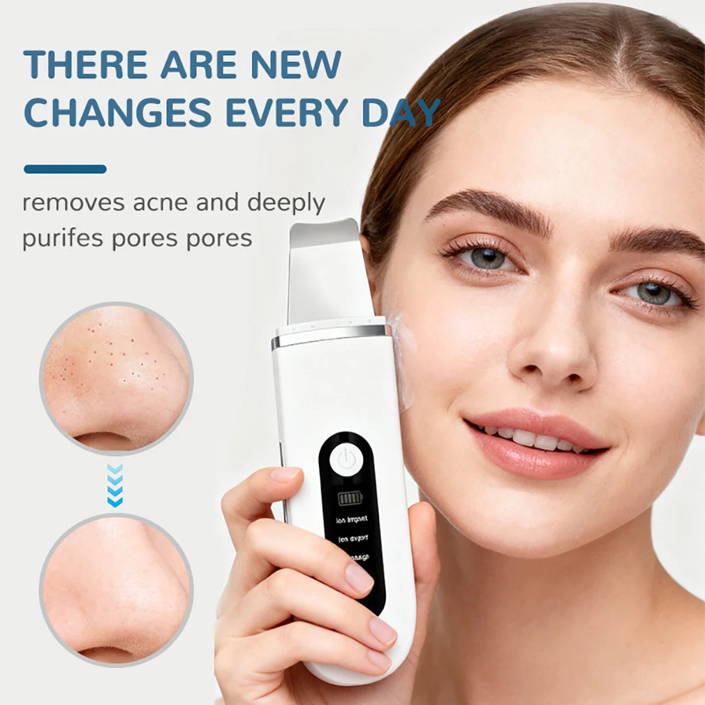 Ultrasonic Skin Scrubber 4 in1 Ion Import Export Face Cleansing Massage Peeling Spatula Blackhead Remover Pore Purifying  Facial Shovel Cleanser Lifting Skin Care