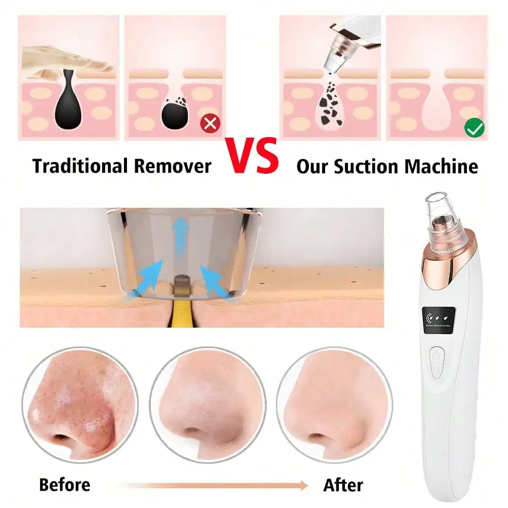 Electric Vacuum Suction Blackhead Remover USB Rechargeable Facial Pore Cleaner Comedone Spot Acne Pimple Black Head Extractor Face Skin Care Tools