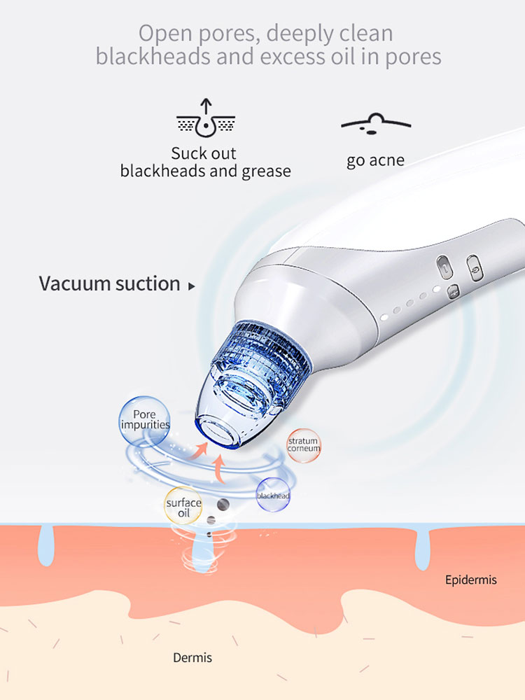 Electric Blackhead Suction Instrument | Home Blackhead Removal Beauty Tool